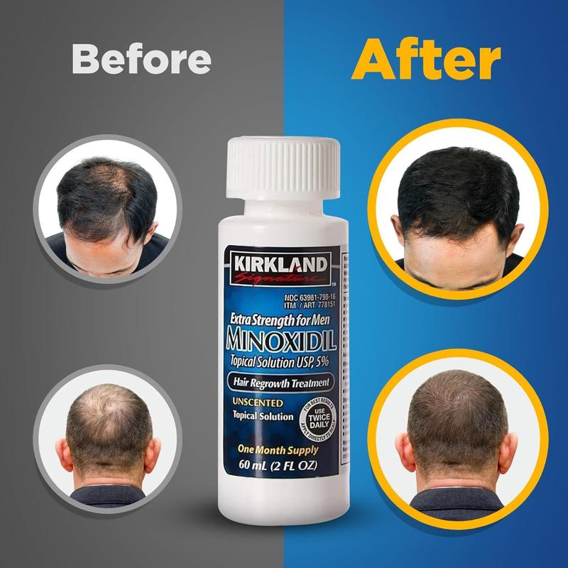 Kirkland Signature Minoxidil 5% Topical Solution for Men - 6 Month Supply (6 x 2 Fl Oz), Hair Regrowth Treatment with Dropper