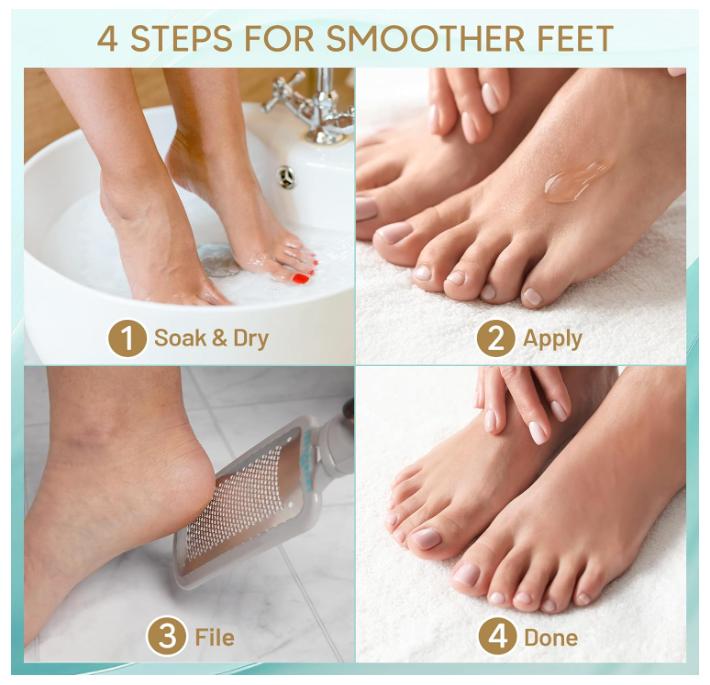 Extra Strength Callus Remover for Feet - Callus Remover Gel Foot Scrubber for Dead Skin - Professional Pedicure Foot Spa Essential, 6oz Kit Restore Salon Smooth