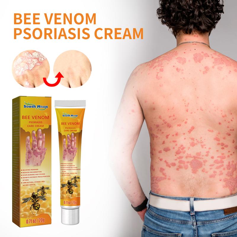 South Moon Bee Venom Psoriasis Cream, Relieve Itchy Skin Repair Hand Moss Moisturizing Skin Care Cream