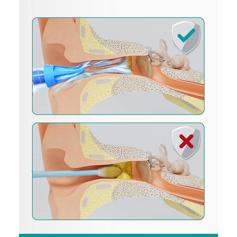 Ear Syringe Ear Wax Removal with 3 Quad-stream Tips - Water Irrigation Ear Cleaner Ear Wax Remover for Improved Hearing Clarity and Aural Hygiene - Ear Syringe Kit Earwax Remover Tool