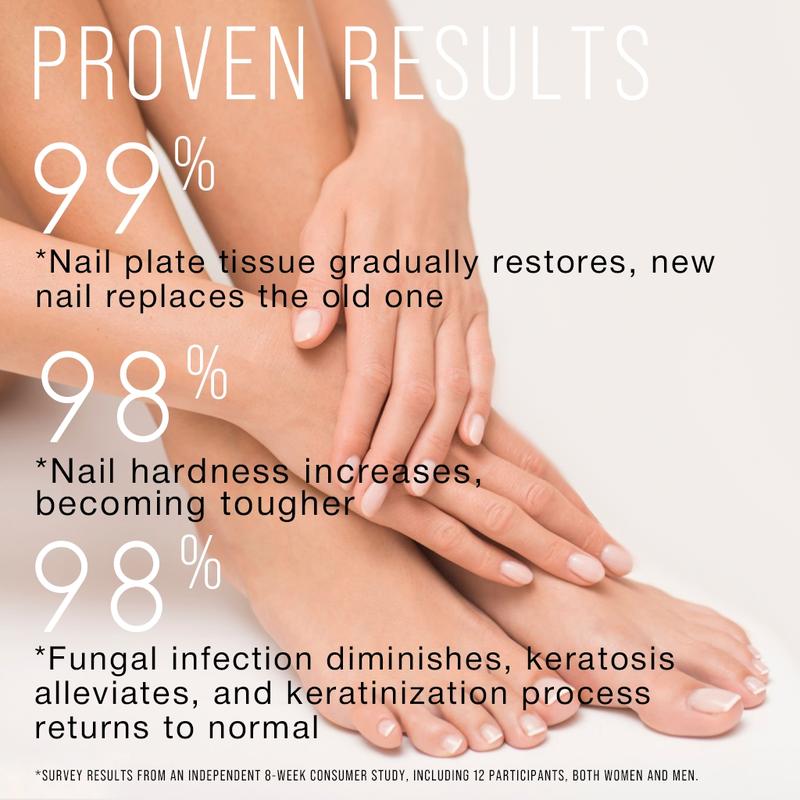 Slo-Brew Plant Drops for Nail Fungus Treatment and Fungal Nail Renewal restores the appearance of discolored or damaged nails.