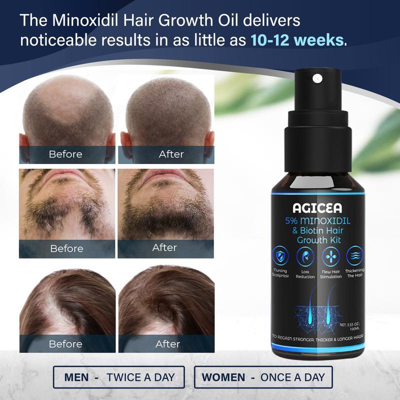 AGICEA 5% Minoxidil for Men and Women kit, Hair Growth Serum with tool-with Biotin - Topical Serum for Scalp Hair Loss Thinning or Longer Hair Care