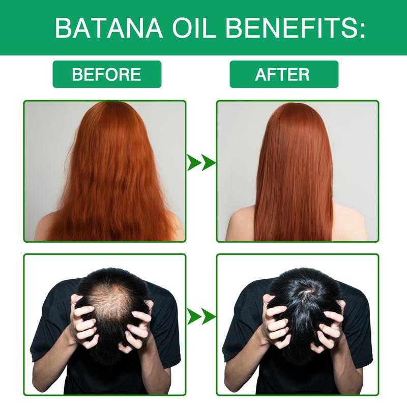 Dr. sebi Batana Oil for Hair Growth, 100% Raw Organic Unrefined Cold Pressed - Natural Ingredients from Honduras Dry Damaged Hair Treatment