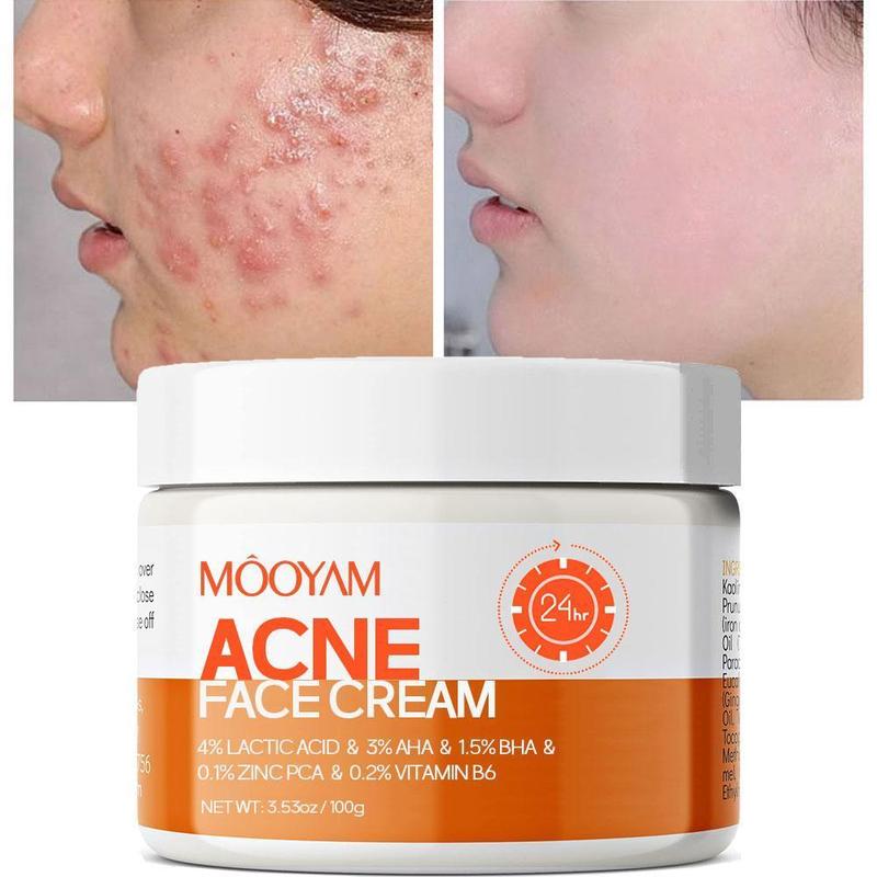 MOOYAM Acne Scar Treatment Cream 50ml Centella & Snail Repair Cream Post-Acne Marks Removal Acne&Pimple Treatment Fragrance Free Paraben Free Skincare Salicylic Skin Repair Sensitive Teens Scent