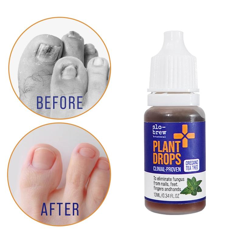 Slo-Brew Plant Drops for Nail Fungus Treatment and Fungal Nail Renewal restores the appearance of discolored or damaged nails.