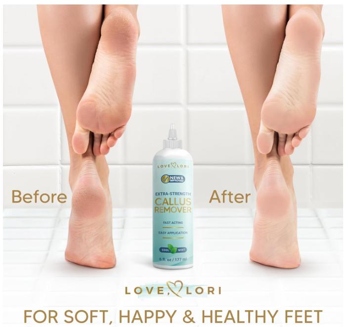 Extra Strength Callus Remover for Feet - Callus Remover Gel Foot Scrubber for Dead Skin - Professional Pedicure Foot Spa Essential, 6oz Kit Restore Salon Smooth