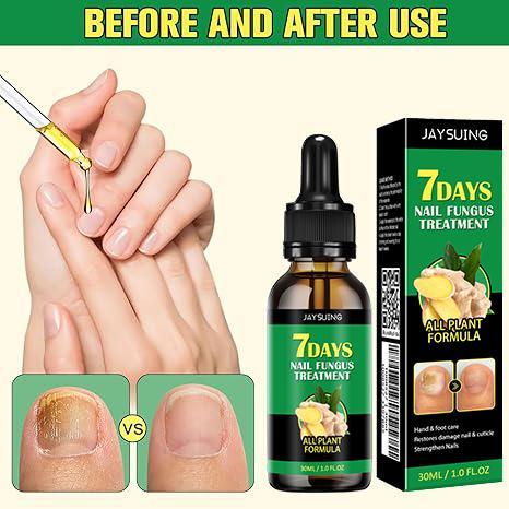 [3 Packs Only $14.99] JAYSUING 7 Days Ginger Nail Oil, Nail Care Essence for Moisturizes and Thickens Nails -longer, Stronger and Brighter Nails