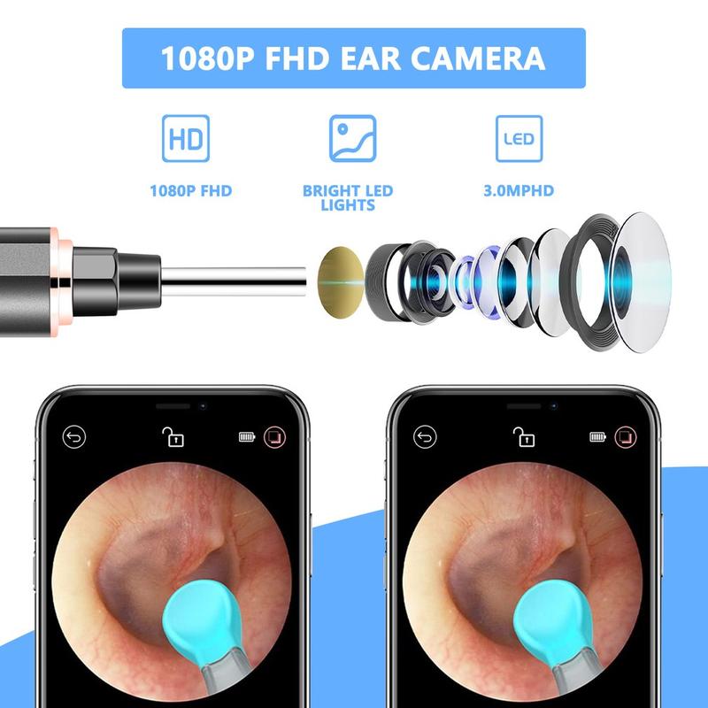 Wireless Wifi Smart Otoscope Earwax Removal Tool Ear Endoscope With Led Light Visual Ear Scope For Adults And Children