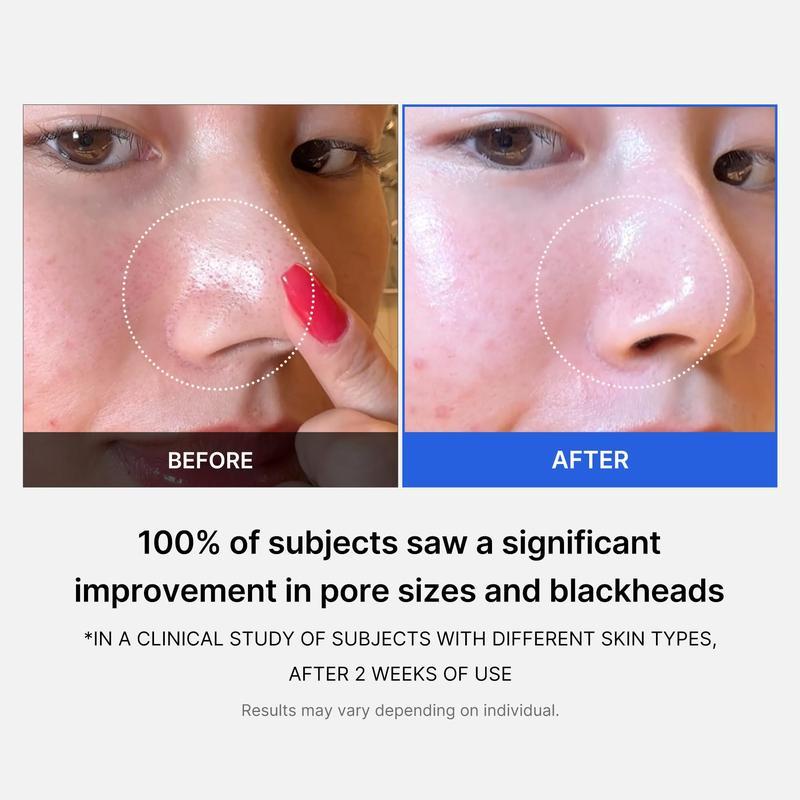 Medicube Zero Pore Pads 2.0, Dual-Textured Facial Toner Pads for Exfoliation and Pore Care with 4.5% AHA Lactic Acid & 0.45% BHA Salicylic Acid, Ideal for All Skin Types, Skin Care (70 Pads)Limited time discount