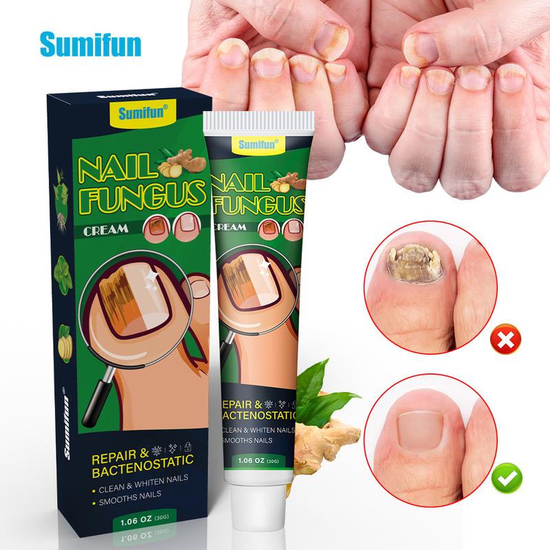 Nail Treatment Repair Gel, Tea Tree Oil for Nails, Nail Care Manicure, Nail Repair Cream, Nail Treatment Repair Gel for Health and Beauty, Gel for Nail Growth and Care Nail Polish Comfort