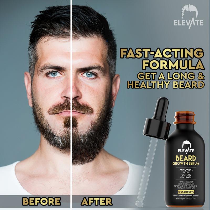 Elevate Beard Growth Oil 5% Minoxidil Hair Growth Serum Biotin & Caffeine - Stronger Thicker Fuller Beard Natural Gentle Comfort Treatment Hair Care