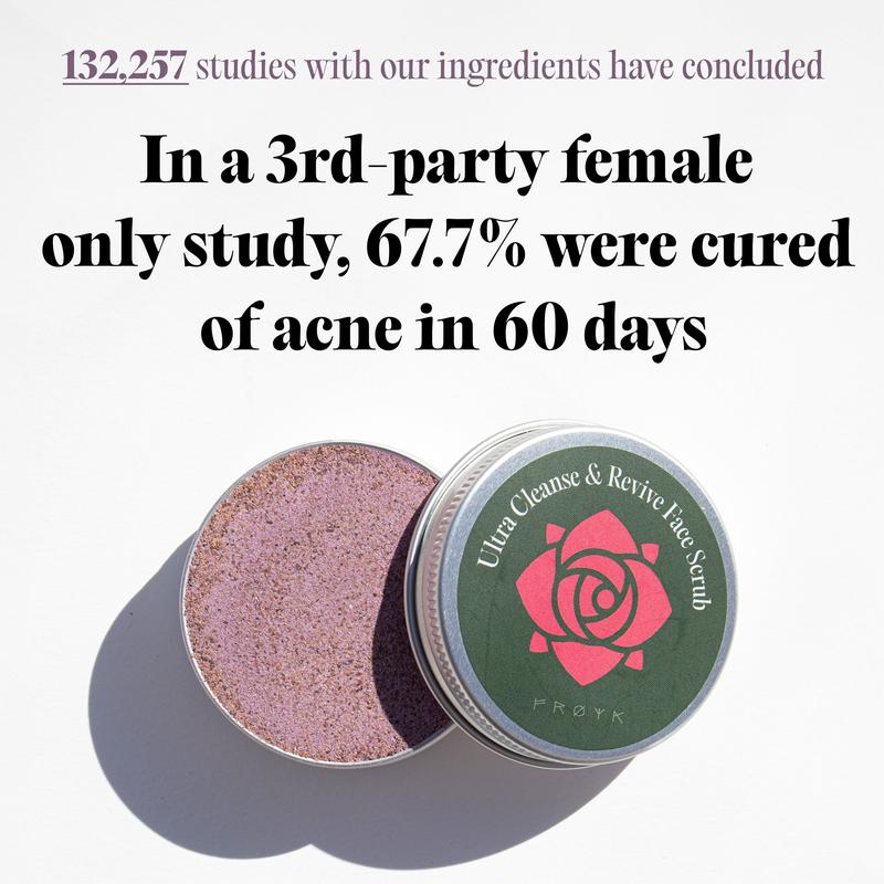 The Complete Acne System for Women-Natural Soothing Balm 3-Step Acne System for Women