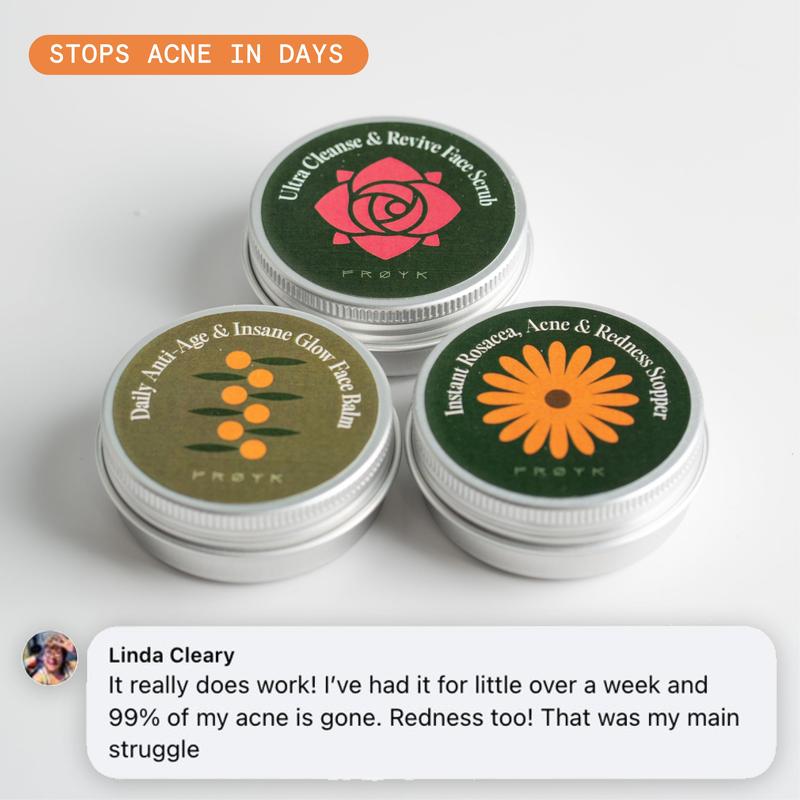 The Complete Acne System for Women-Natural Soothing Balm 3-Step Acne System for Women