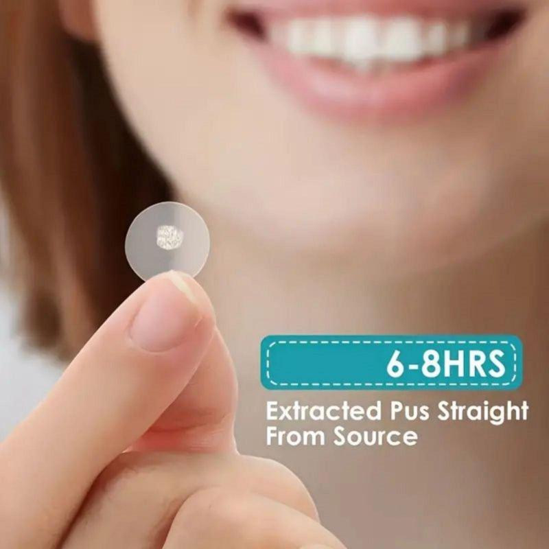 Acne Patch, 1080pcs set Invisible Acne Cover Patches, Facial Skin Care Product for Women & Men Daily Use