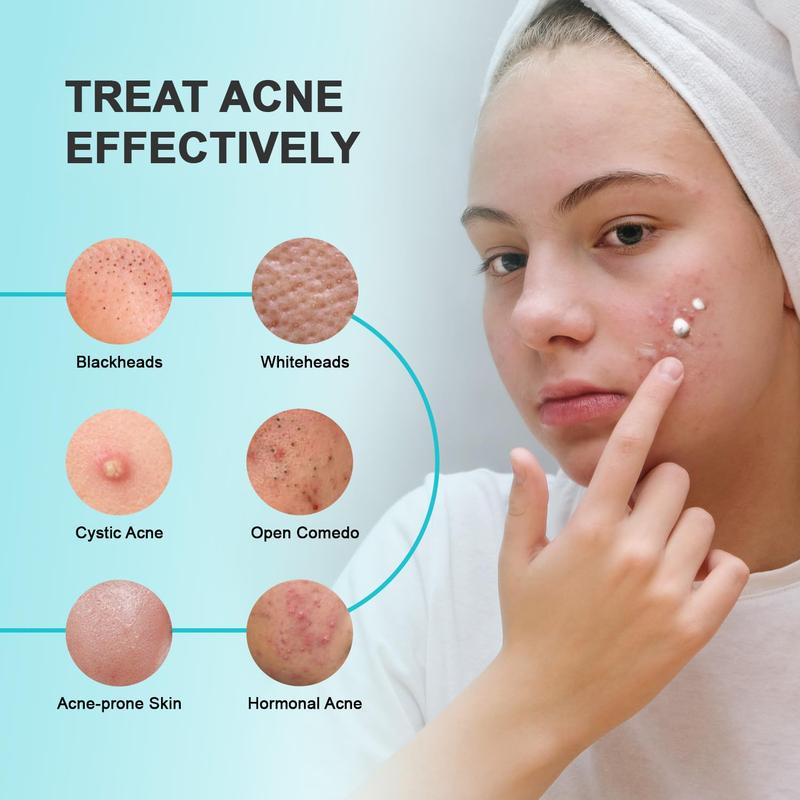 Cystic Acne Spot Treatment Cream: For Face, Back, Body - Hormonal Acne Moisturizer for Teens & Adults, Relieves Breakouts, Redness & Swelling.