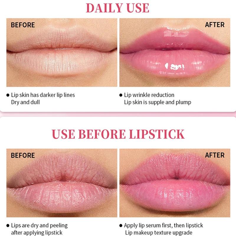 Lips Pink Serum Remove Dark Smoke Lip Plumping Oil Bleaching Melanin Repair Lip Lines Moisturizing Brighten Lip Care Cosmetics