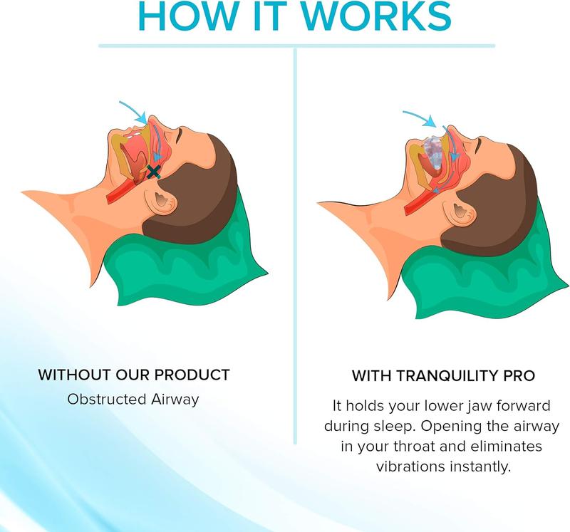 Tranquility PRO 2.0 Anti-Snoring Mouth Guard - Adjustable Mouthpiece - Night Time Teeth Mouth Guard & Sleeping Bite Guard for Bruxism and Stop Snoring - Custom Molding & Adjustability Comfort