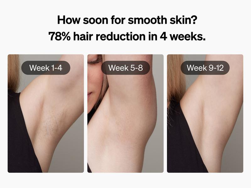 Ulike Air+ Laser Hair Removal for Women and Men, Air Ice-Cooling for Salon-Level Result at Home, Safe and Long-Lasting Hair Reduction for Body, Face & Bikini, hair salon at home, White, Comfortable to use ipl device