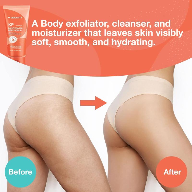 KP Bump Eraser Body Scrub, Keratosis Pilaris Treatment, Strawberry Legs Treatment, for Women & Men Exfoliation