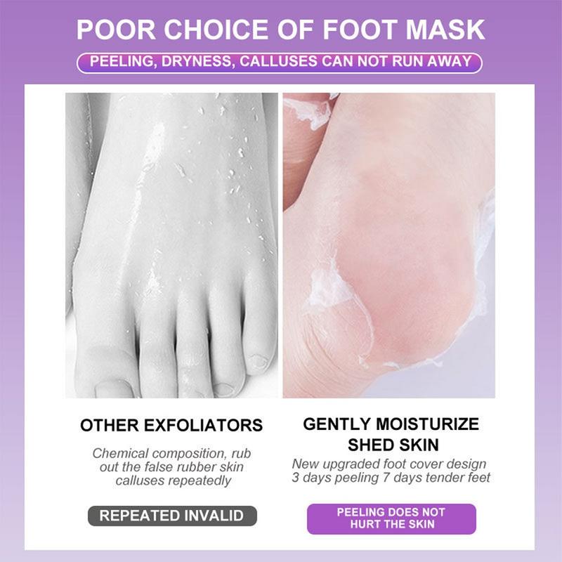 Foot Exfoliating Mask (5 pairs)  Removes Dead Chapped Feet and Calluses Spa Treatment Made with Aloe Vera Extract lavender Scent Foot peel mask Friend