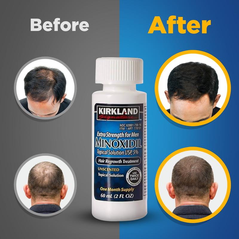 Kirkland Signature Minoxidil Liquid Extra Strength Hair Loss Regrowth Treatment for Men, 5% Topical Solution, Dropper and Comb Included