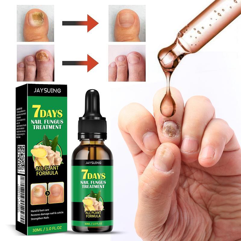 JAYSUING Ginger Nail Treatment Nail Support Nail Care Nail Polish Comfort