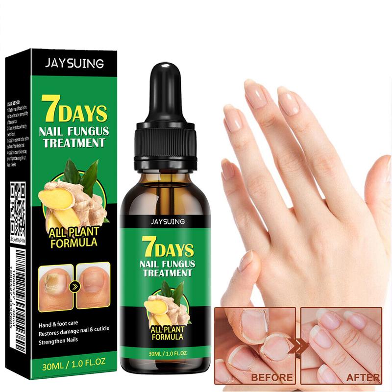 Multi-Purpose Ginger Nail Oil, Get Longer, Stronger and Brighter Nails, Moisturizes and Thickens Nails for Women & Men