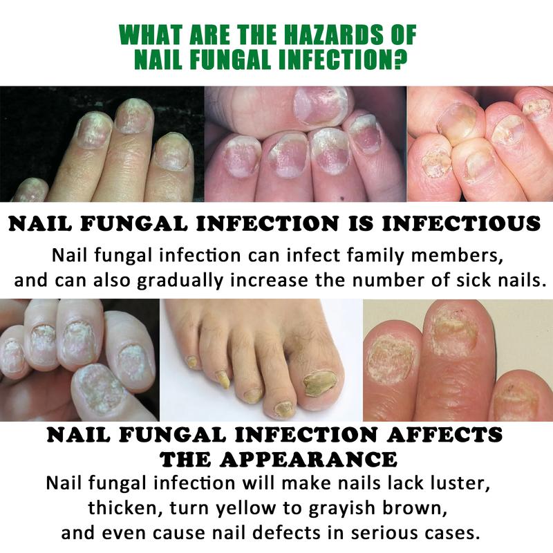 healthy Nail Treatment Nail support care repair