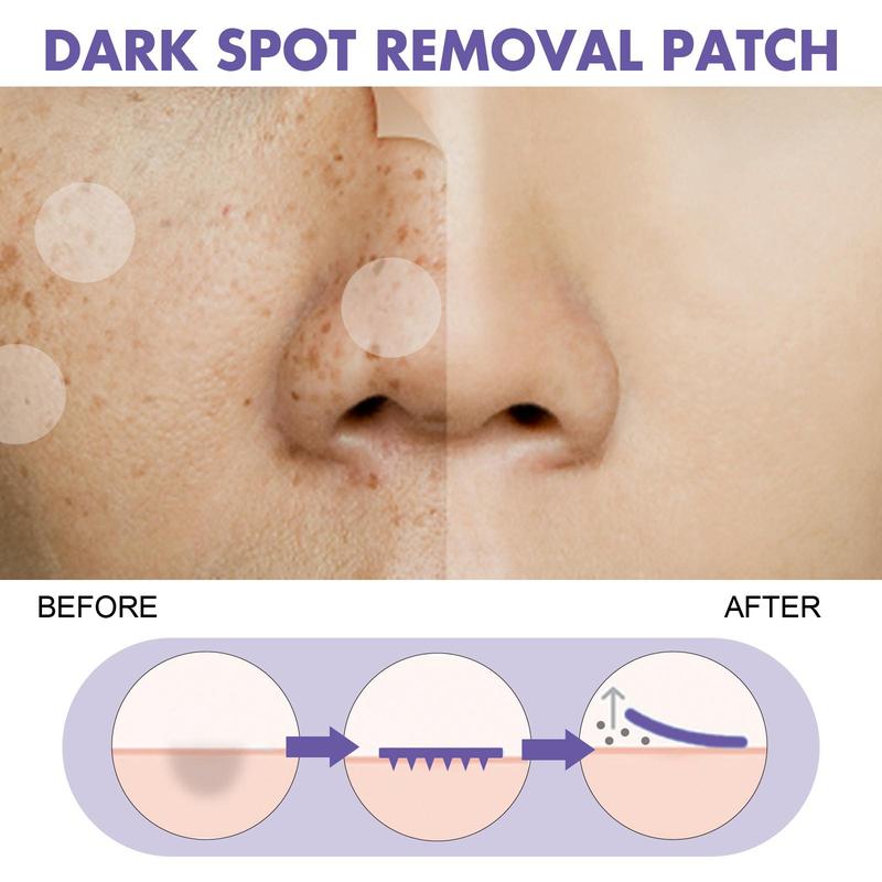 144Pcs Hydrogel Patches Dark Spot, Old Age Spot Care Patches for Face, Relieve Dark Spots, Freckles, Blemishes, Age Spot After Using Dark Spot Patch