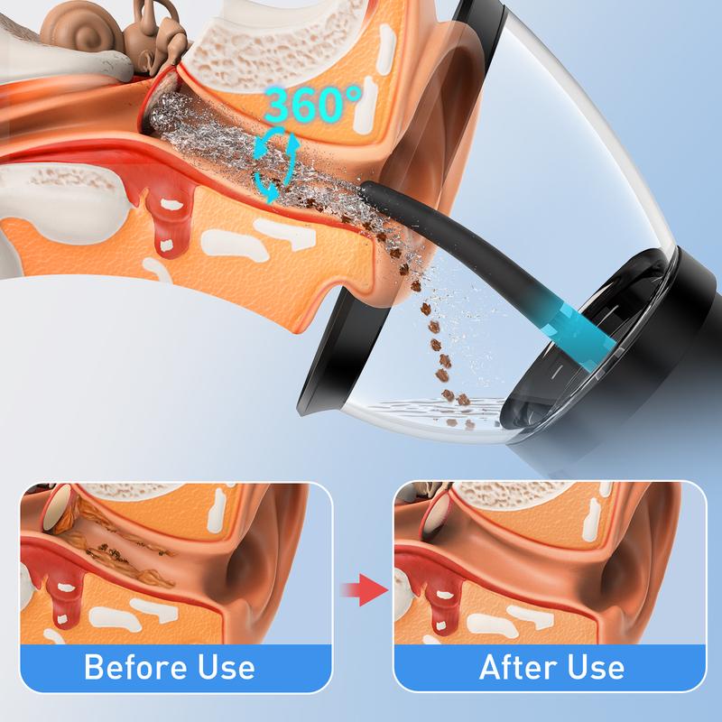 HeaDot Retractable Ear Wax Removal Upgrade: Safe and Effective Ear Cleaner with Waste Tank, Ear Irrigation Kit with USB - C Cable, IPX6 Waterproof