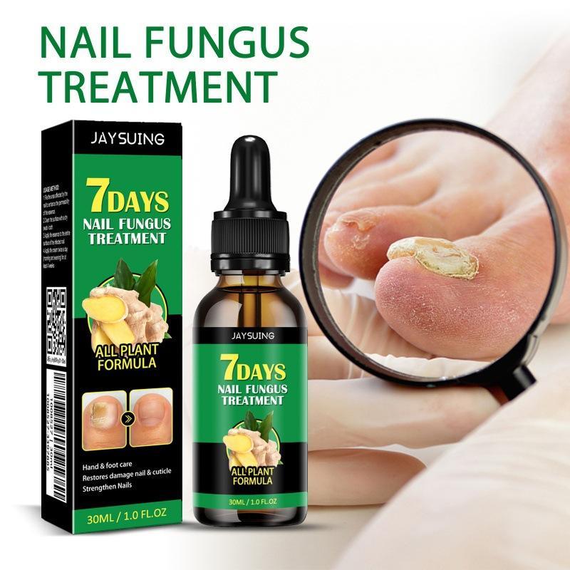 [90% People Choose] Nail Growth Serum Ginger Extract NailEssence -Repair and Strengthen forClowing, Beautiful Nails