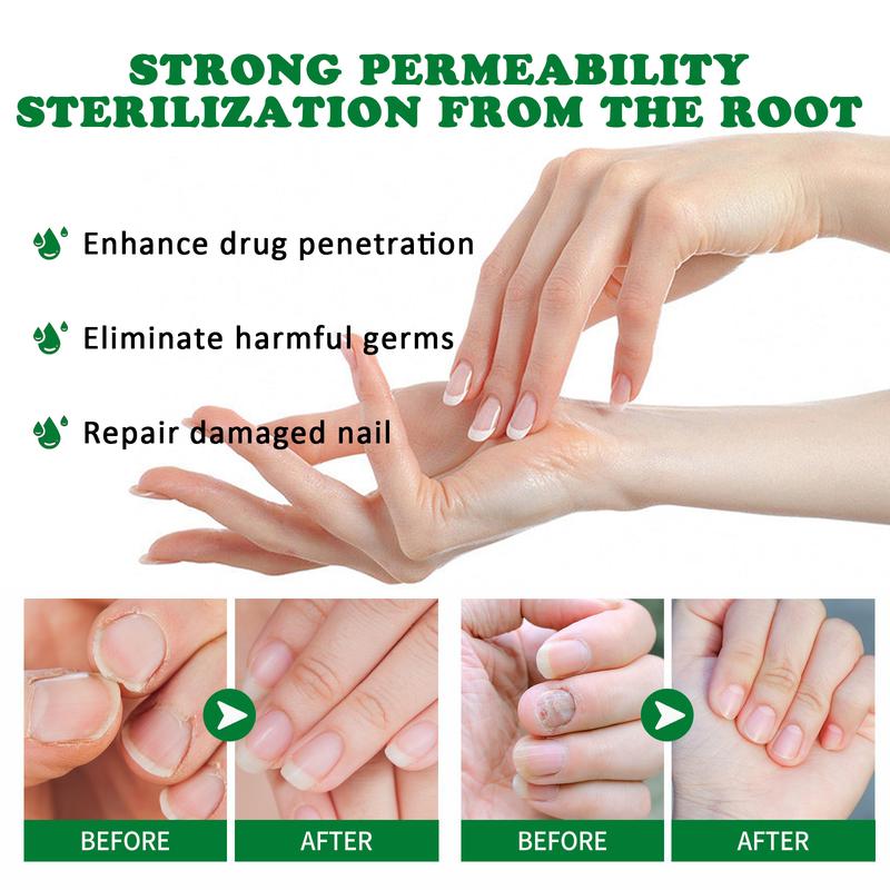 healthy Nail Treatment Nail support care repair