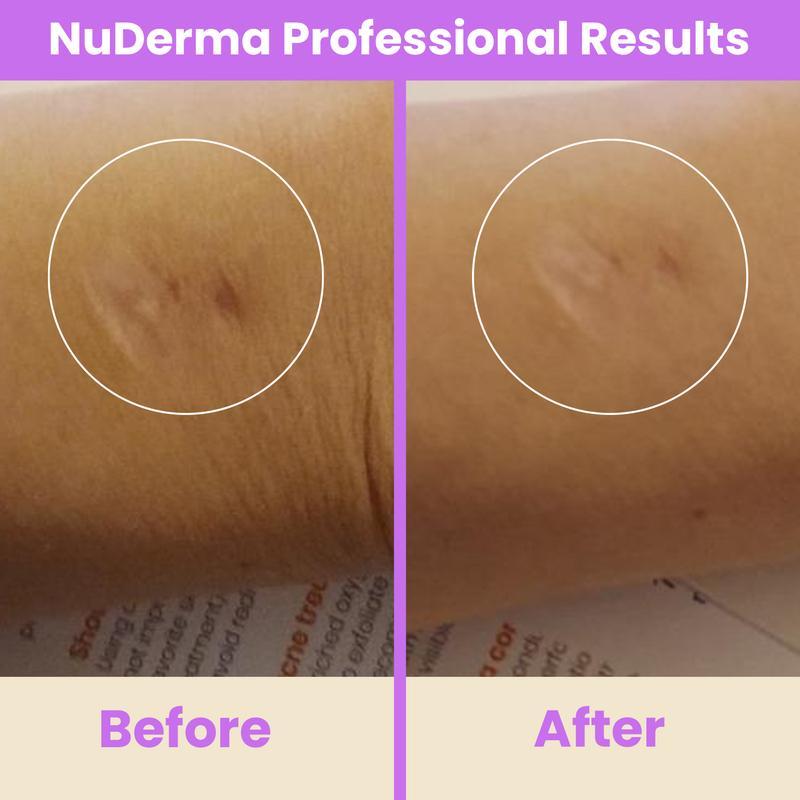 NuDerma Professional High Frequency Wand by Pure Daily Care with Argon and Neon Applicator for Anti-Aging and Anti-Acne