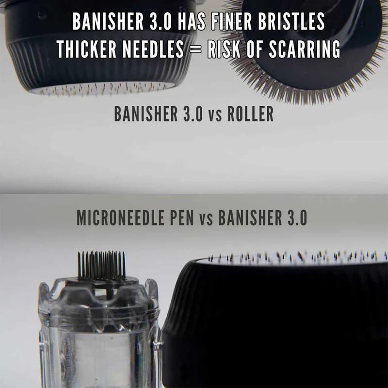 3 Pack Replacement Heads for Banisher 3.0 Microneedling Device for Acne Scars, Collagen Banking, Dark Spots, Wrinkles