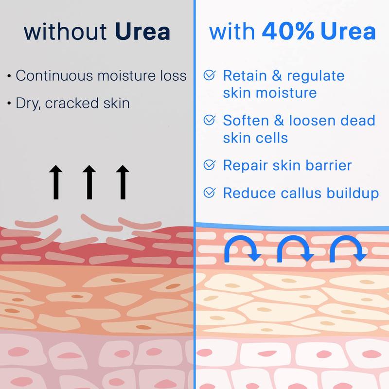 Ebanel Urea Cream 40% plus Salicylic Acid 2%, Foot Cream for Dry Cracked Heels Feet Knees Elbows Hands, Foot Dead Skin Cuticle Callus Remover Toenail Softener, Keratolytic Skin Barrier Repair Cream