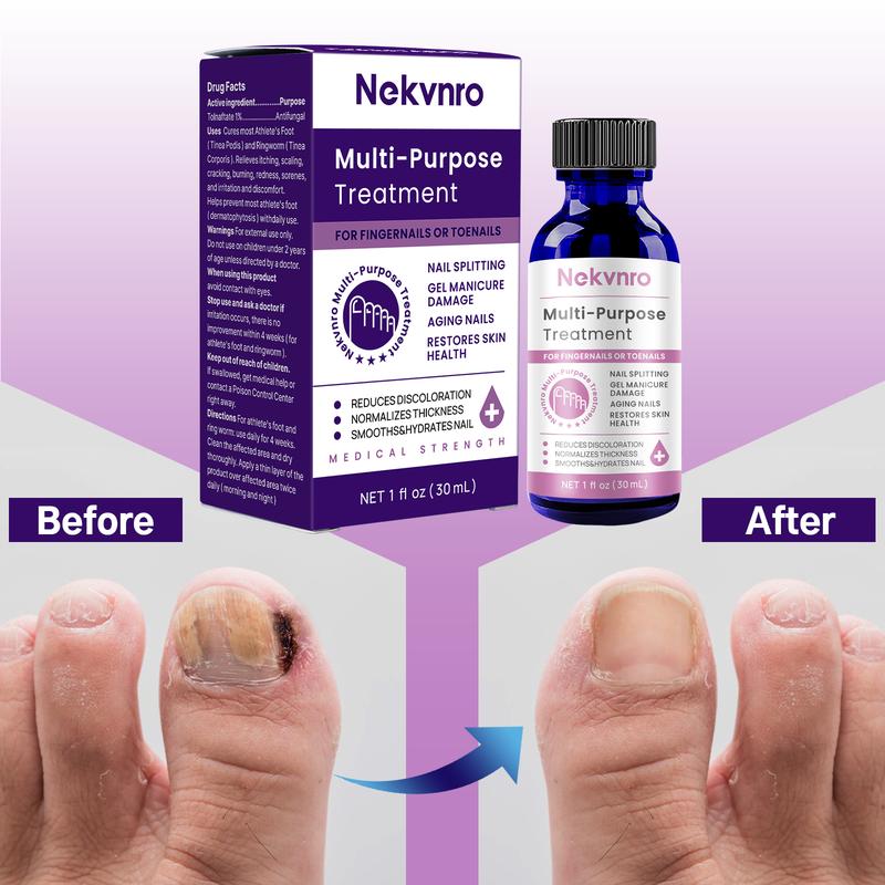 Nail polish, nail remover, nail onychomycosis liquid, nail thickening, soft nails, nail onychomycosis repair liquid