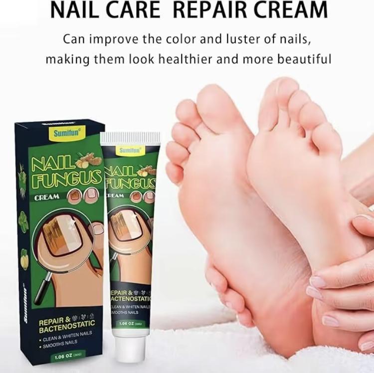 Healthy Nail Essencerepair gel, nail repair nail care nail art, treatmentof nail removal cream fungus infection paronychiaComfort Manicure Nail Polish ginger nail