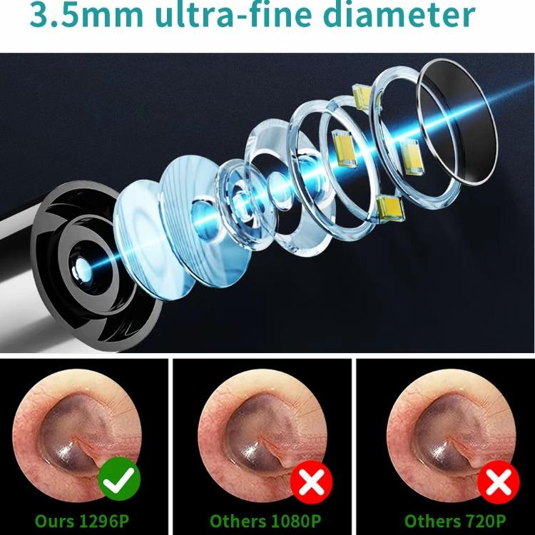 Ear Wax Removal Tool with Camera and Light - 1080P Ear Cleaner Kit for iOS & Android, Includes 6 Spoons for Safe and Effective Cleaning.  FSA HSA Eligible, Perfect Ear Cleaning Solution in Sleek Black Design!