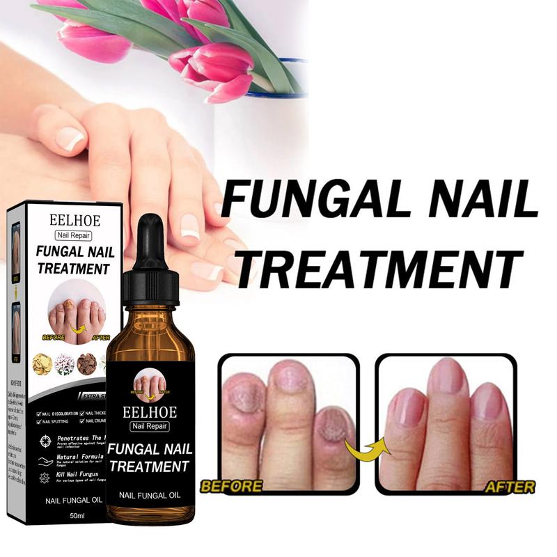 EELHOE Nail Repair Solution Thickening Bright Nails Remove Onychomycosis Dead Skin Repair Moisturizing Nail Art Nutritional Care Solution