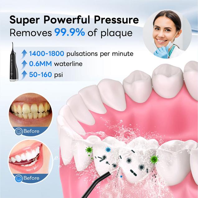 4 in 1 Water Flosser For Teeth_Oral lrrigators, 310ML Rechargeable Travel Flosser, IPX7 Waterproof Electric Water Flosser for Teeth Cleaning.Capacity upgrade_large capacity.