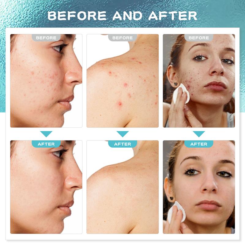 Cystic Acne Spot Treatment, Hormonal Acne Treatment for Face，Back and Body, with Salicylic Acid and Tea Tree Oil