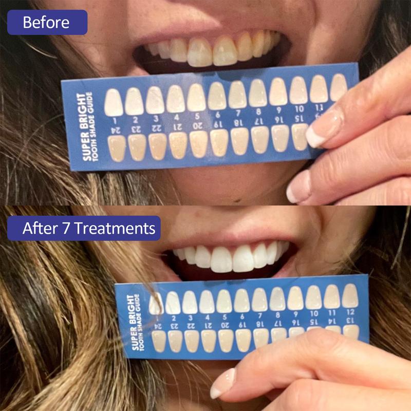 Wavewu Teeth Whitening Kits Teeth  Set Fast Results Oral