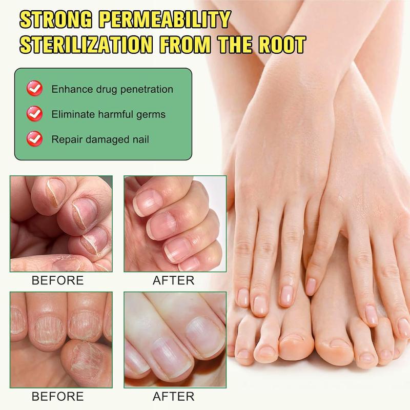 [2 Pack 60%ОFF] 7 Days Nail Care Serum Ginger Extract Nail Essence - Repairand Strengthen for Glowing, Beautiful Nails