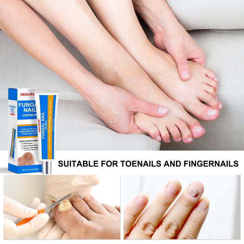 HEALMUSZ Nail Fungus Cream - Repair Damage and Fungal Infections - Clear and gentle recovery oregano tea Healthcare Treatment footcream