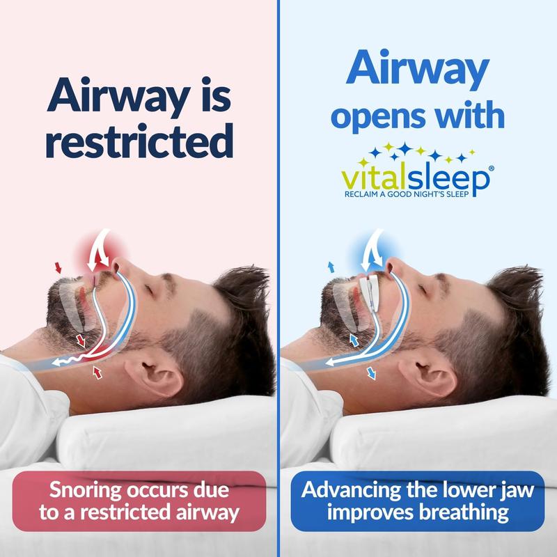 VitalSleep Snoring Solution - Effective Remedy for Snoring