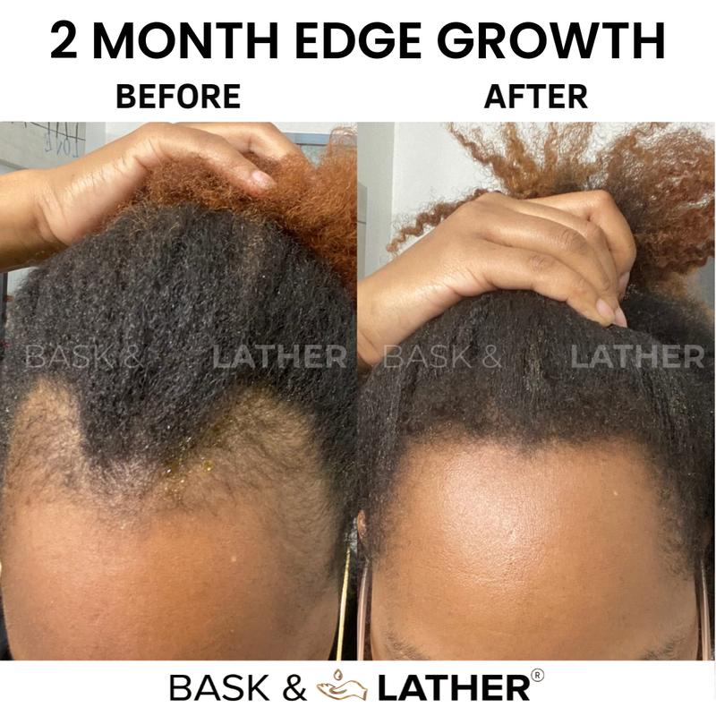 Scalp Stimulator + Hair Elixir- Growth + Length Retention Bundle Haircare Oil Castor Oil Vitamins