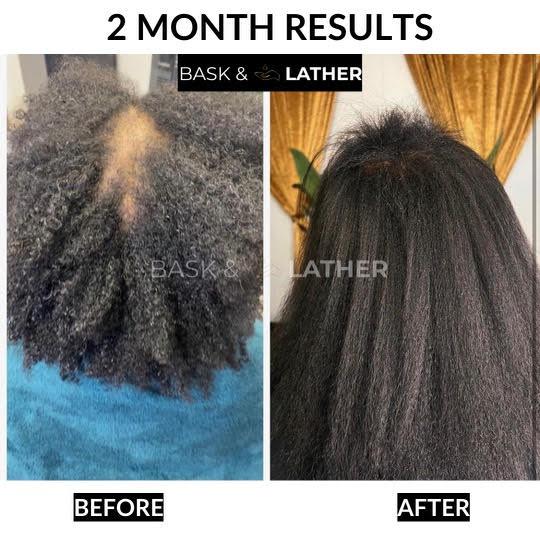 Scalp Stimulator + Hair Elixir- Growth + Length Retention Bundle Haircare Oil Castor Oil Vitamins