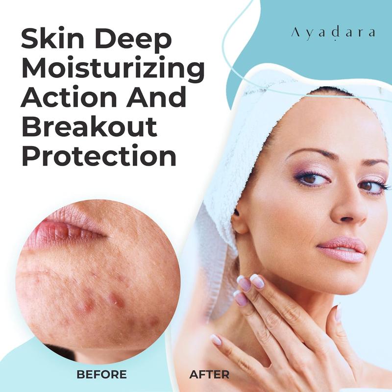 AYADARA Breakout Warrior Acne Cream Facial Flower