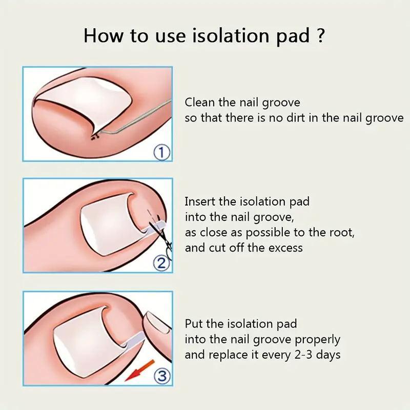 Ingrown Toenail Treatment Kit, Including 50pcs Flexible Silicone Ingrown Toenail Corrector Strips & Toenail Lifter & Nail Clipper, Professional Ingrown Toenail Correction Tool, Christmas Gift