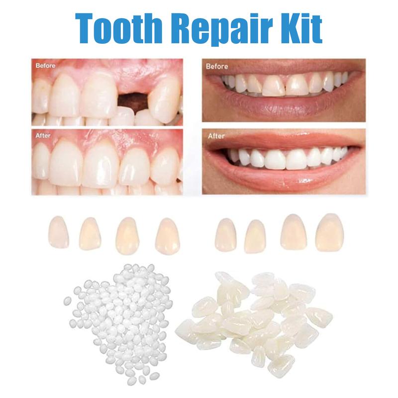 Dental Repair Denture Repair Beads,Tweezers,Dental Pick,Dental Tools for Fixing Filling Missing Broken Tooth Moldable Fake Teeth Oral Clear Restore Adjustable Snap-On Veneer Teeth Covers